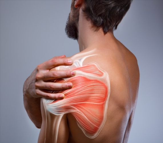 Graphic of a shoulder injury showing under the skin